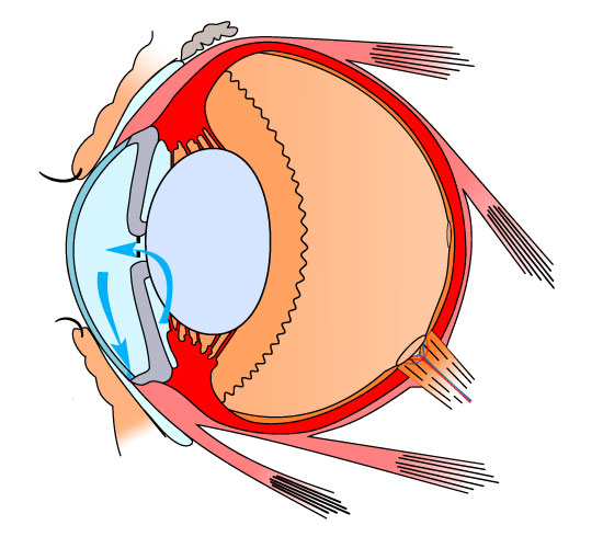 Advances in technology, medicine, and expertise combine to preserve vision in more people